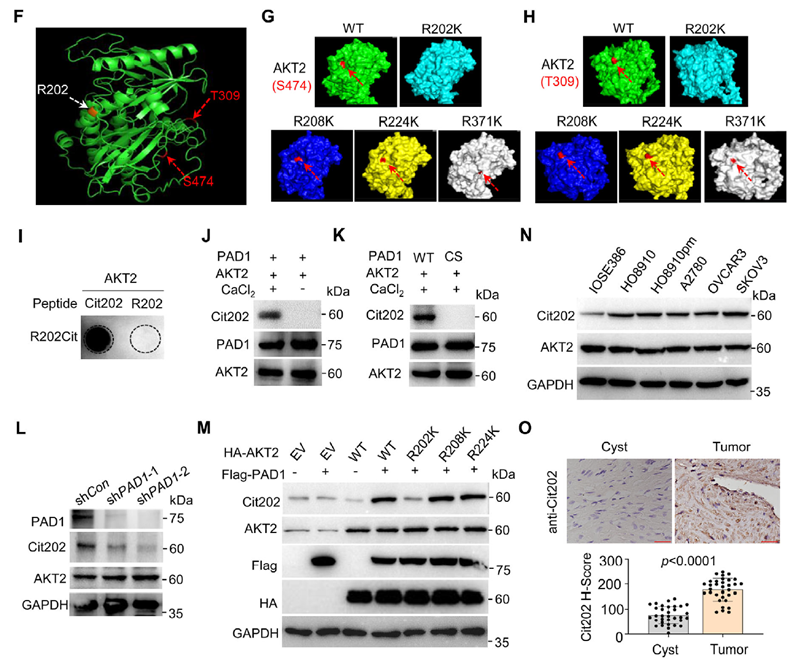 PAD1-mediated citrullination of AKT2 at R202 promotes AKT2 enzymatic activity in OC cells