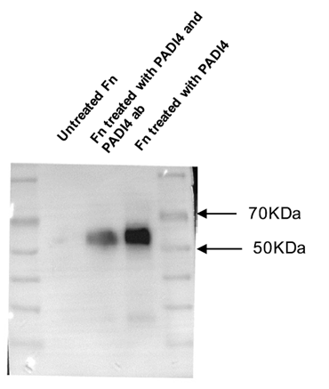 Identification of fibronectin citrullination by anti-PADI4 monoclonal antibody