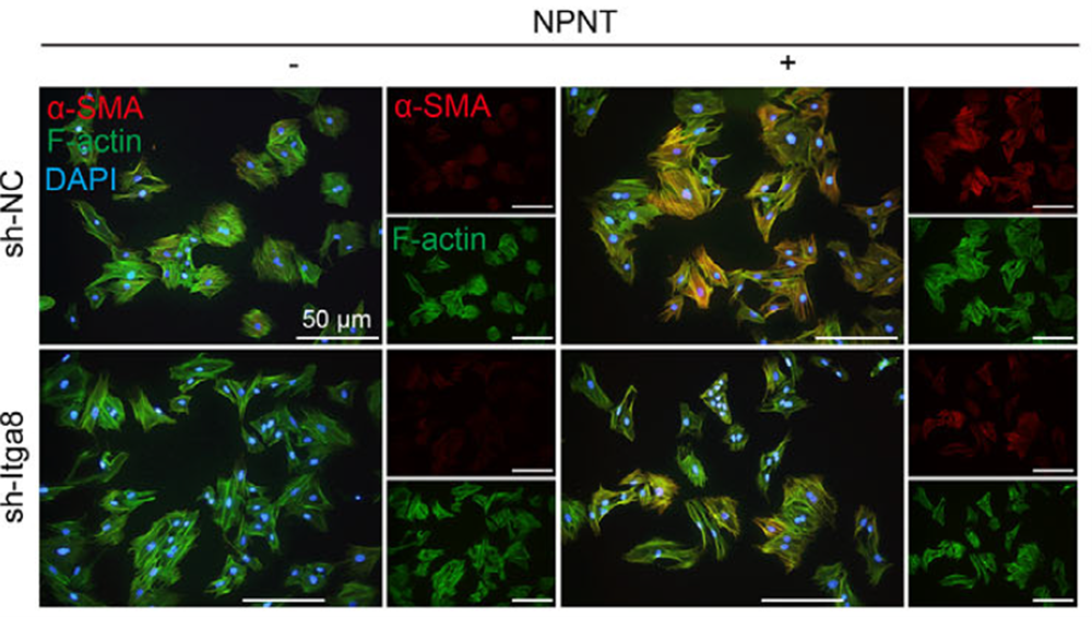 Itga8 promotes fibroblast contraction and migration through FAK and RhoA/ROCK signaling pathways