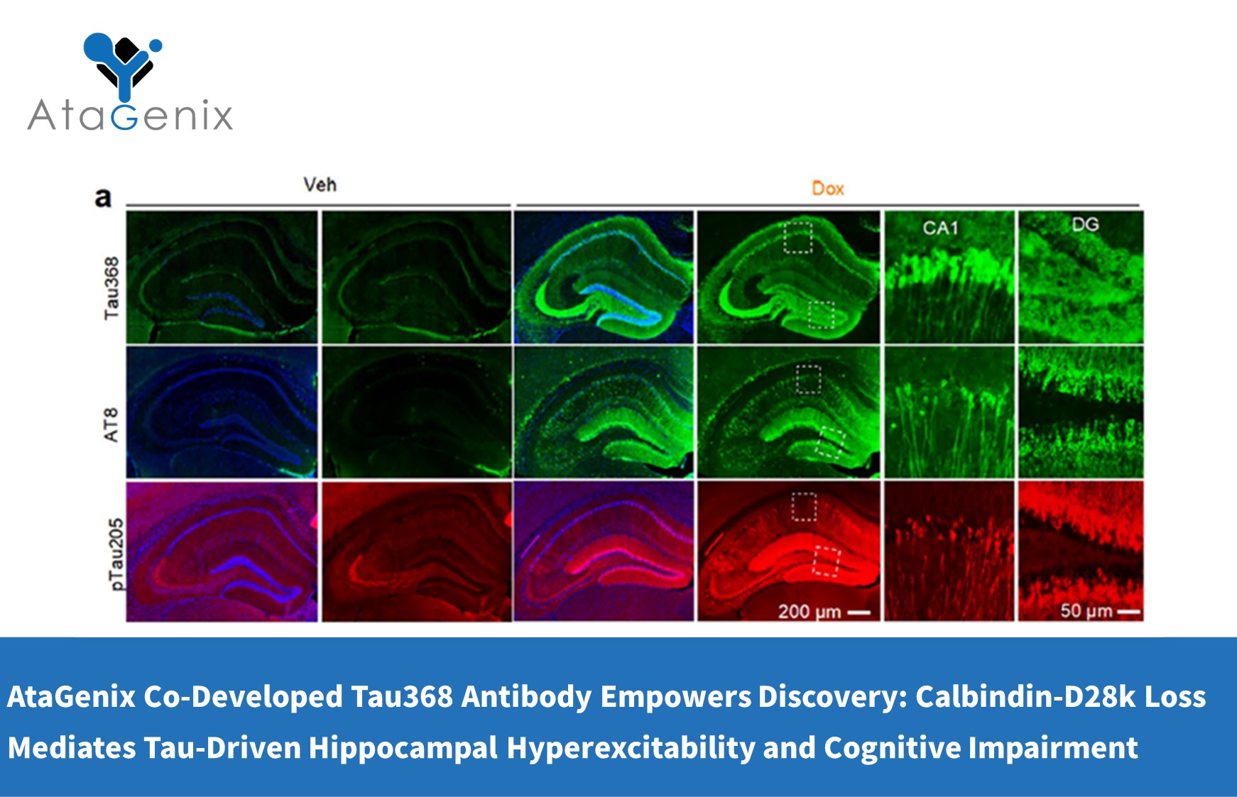 AtaGenix Co-Developed Tau368 Antibody Empowers Discovery: Calbindin-D28k Loss Mediates Tau-Driven Hippocampal Hyperexcitability and Cognitive Impairment
